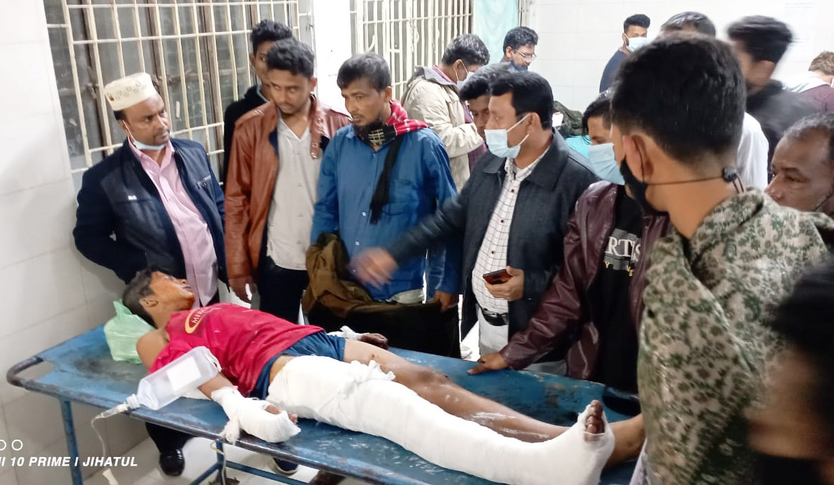 কুমিল্লায় বেলুনের গ্যাস সিলিন্ডার বিস্ফোরণে আহত ৩০ কুমিল্লায় বেলুনের গ্যাস সিলিন্ডার বিস্ফোরণে আহত ৩০
