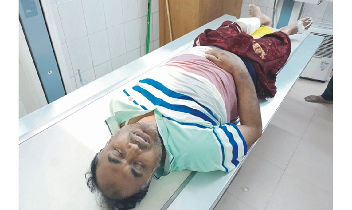  কুমিল্লায় শিক্ষা প্রকৌশল অধিদপ্তরের ঠিকাদার যুবলীগ নেতার উপর হামলা