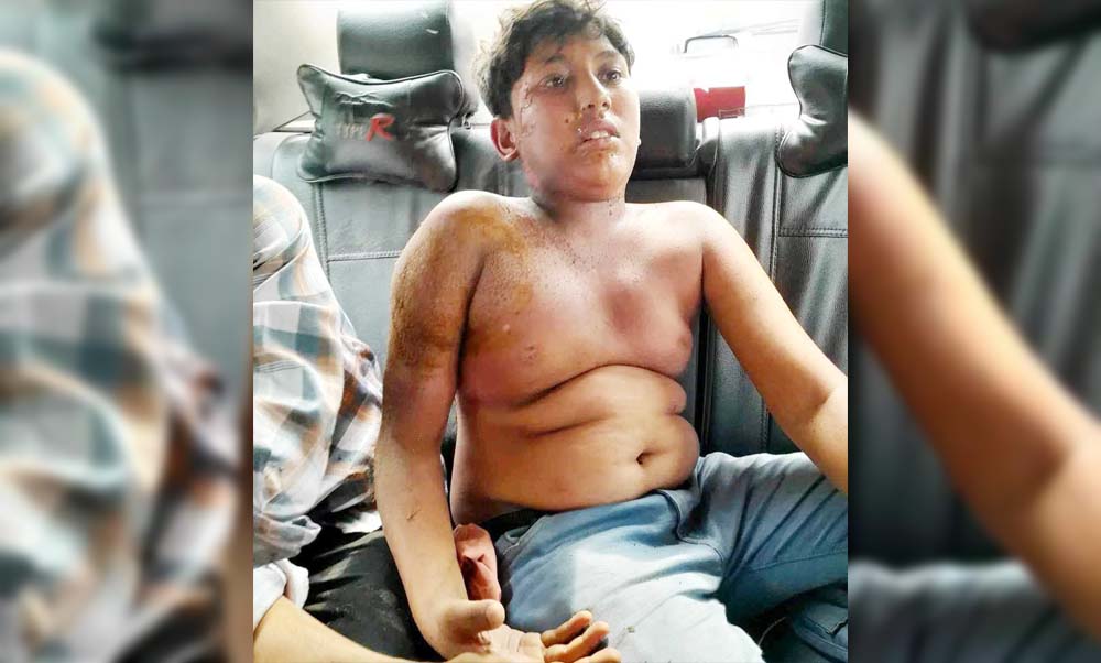 কুমিল্লায় সাকিবের ব্র্যান্ডসপ উদ্বোধন অনুষ্ঠান দেখতে এসে যুবক বিদ্যুতায়িত 