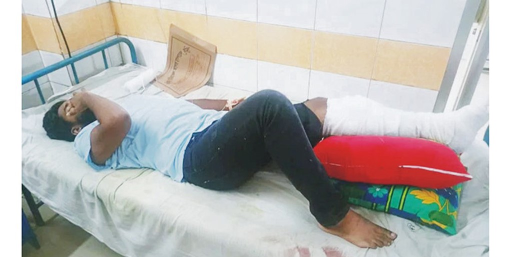 গুলিবিদ্ধ একজন কুমিল্লা মেডিক্যালে চিকিৎসাধীন 