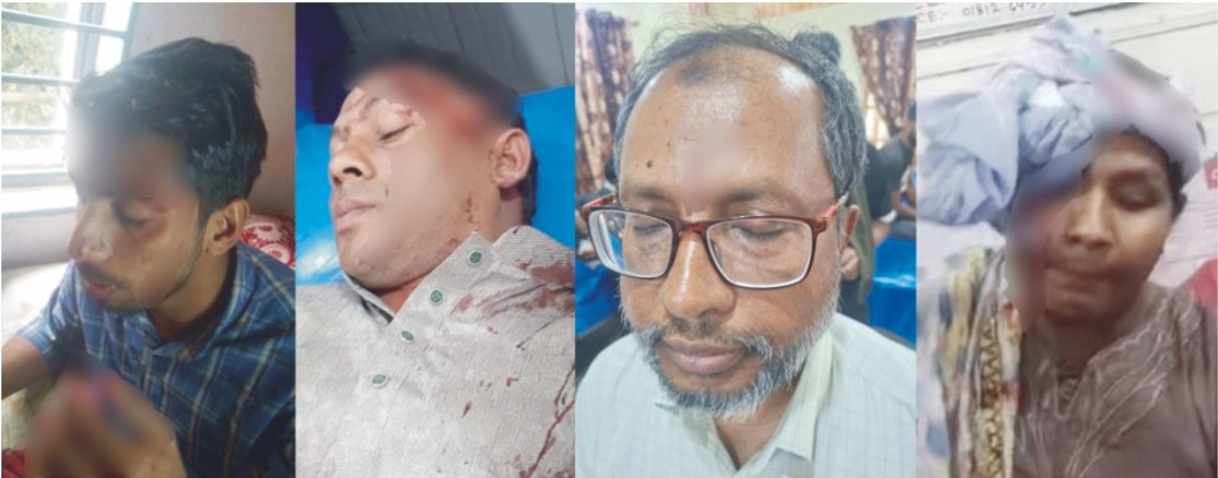  চৌদ্দগ্রামে সমাবেশ থেকে ফেরার পথে জামায়াত-বিএনপির সংঘর্ষে আহত ১০