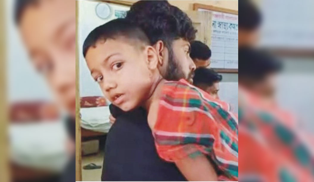  দেবিদ্বারে  কুকুরের কামড়ে  ১৫ জন আহত