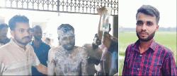  চুরির অপবাদ সইতে না পেরে শরীরে  আগুন দেওয়া সেই অটো চালকের মৃত্যু 