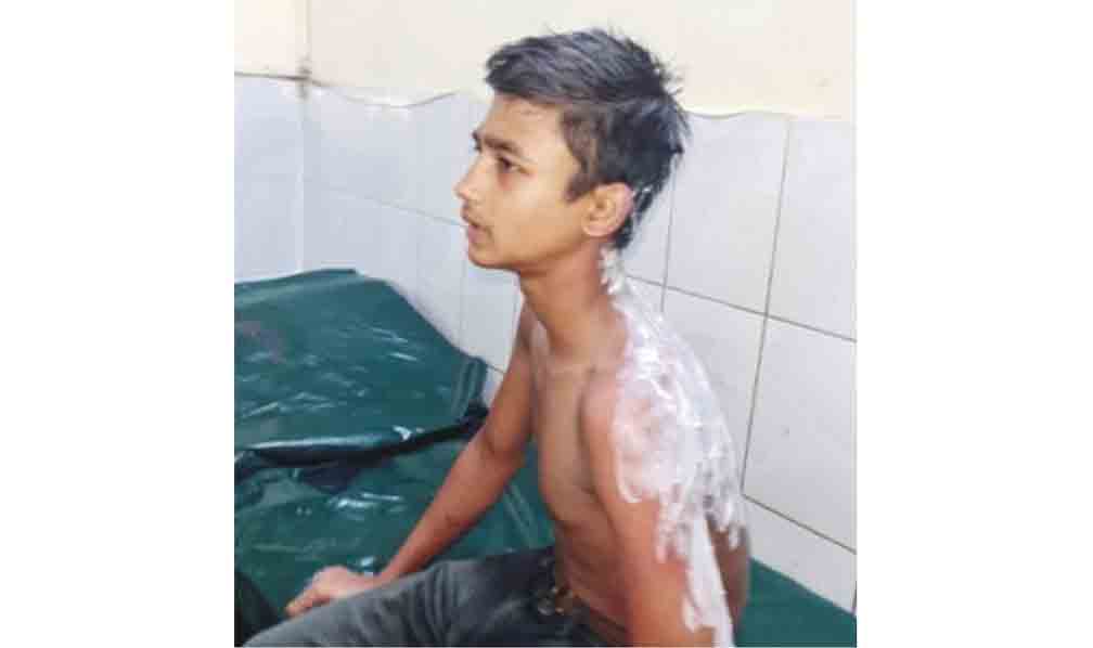  হোটেল কর্মচারীর গায়ে ভাতের গরম মাড় ঢেলে দেয় বাবুর্চি 