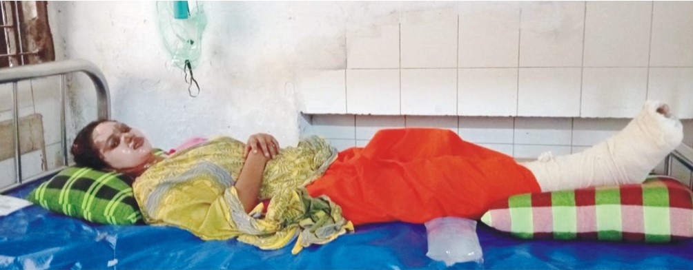 চাচা শ্বশুরের ছোড়া গরমপানিতে ঝলসে গেলো গৃহবধূর শরীর