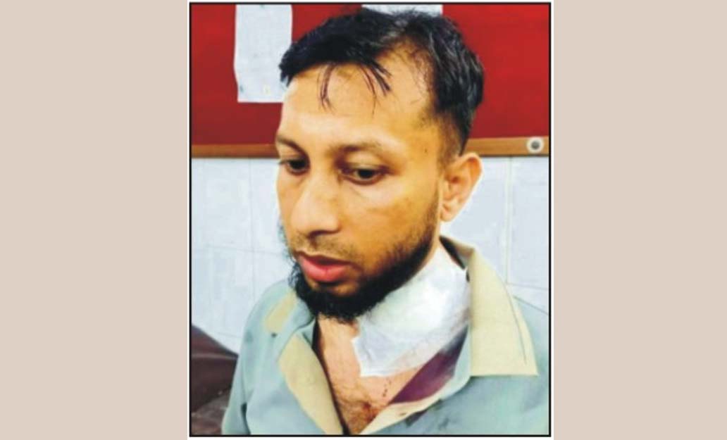 মুরাদনগরের এসিল্যান্ডসহ ৬জন ডাকাত দলের হামলায়আহত